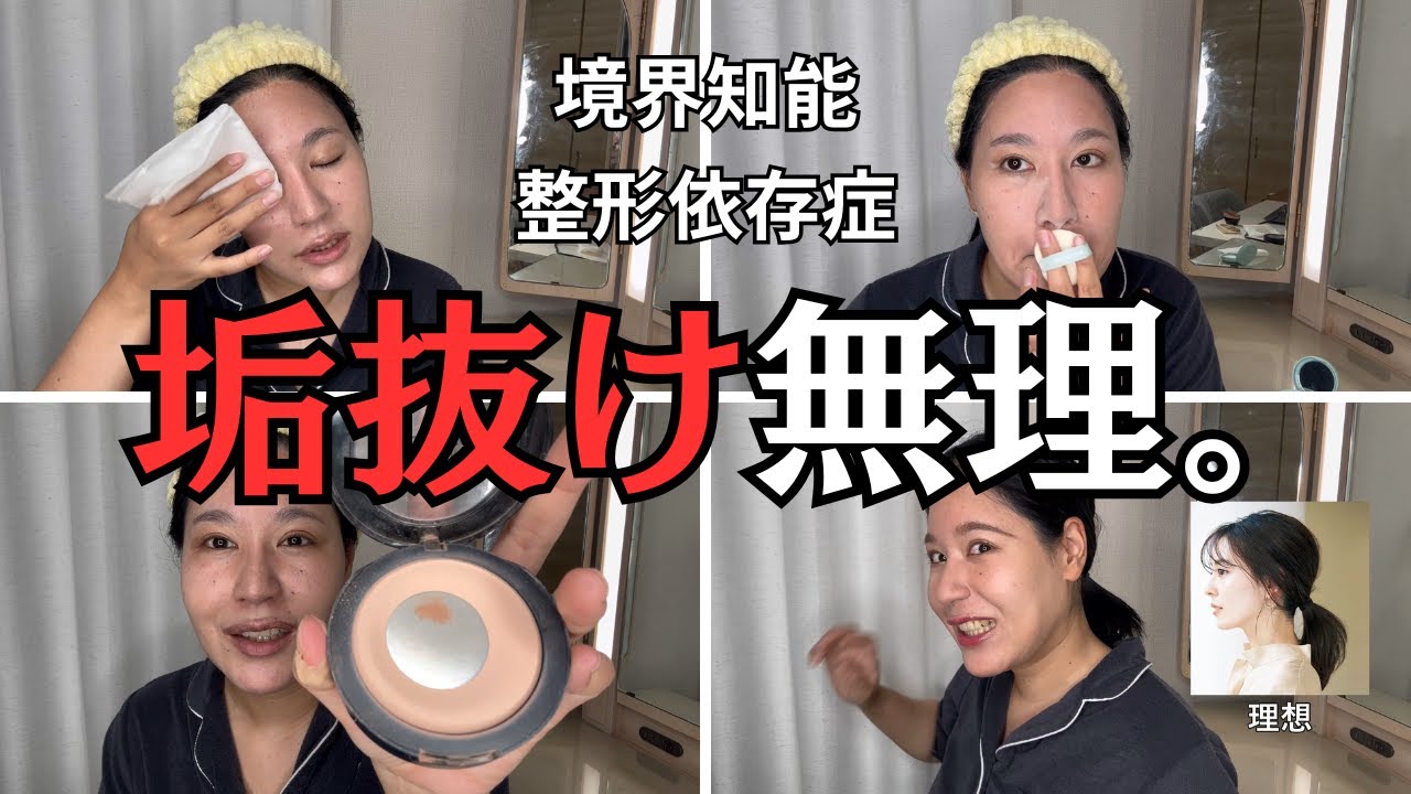 【整形に頼り過ぎた女の末路】境界知能、陰キャ３０代女性のリアル過ぎるメイクルーティン