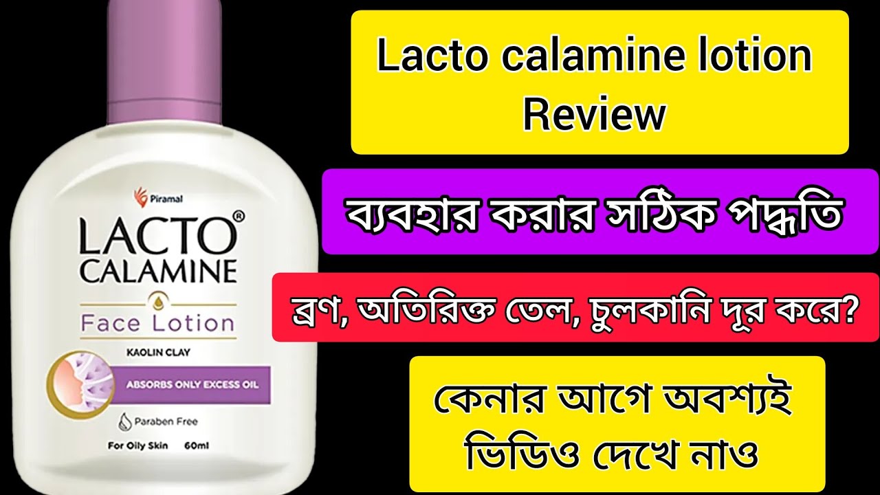 Lacto calamine face lotion review/Lacto calamine face lotion/ review in Bengali