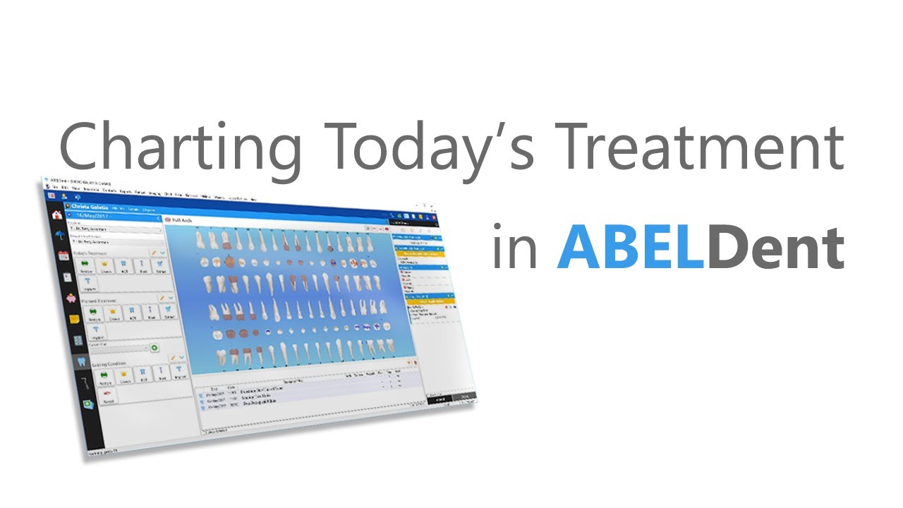 ABELDent Charting - Charting Today's Treatment