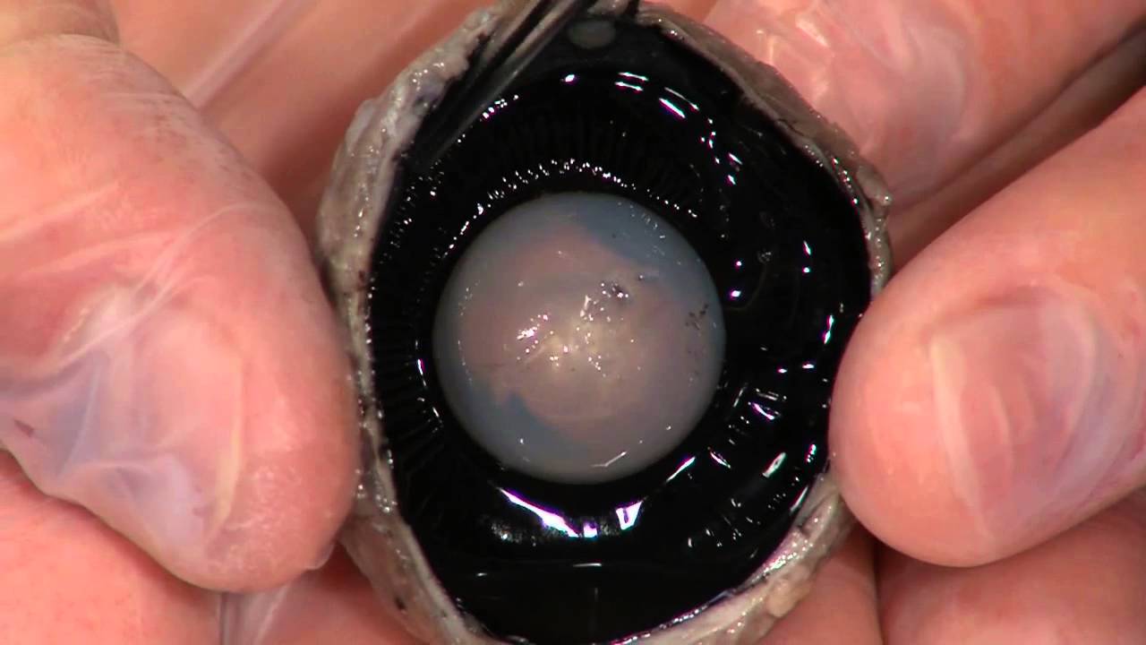 Detailed Cow Eye Dissection: Part II (Jr. High, High School and College Review)