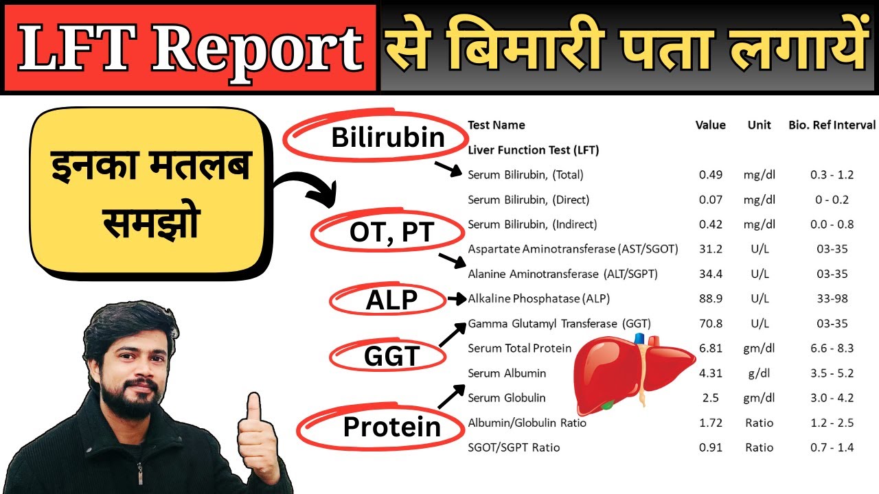 LFT Report Kaise Dekhe | Liver Function Test | Liver Profile | LFT Test | Liver Test Report in Hindi