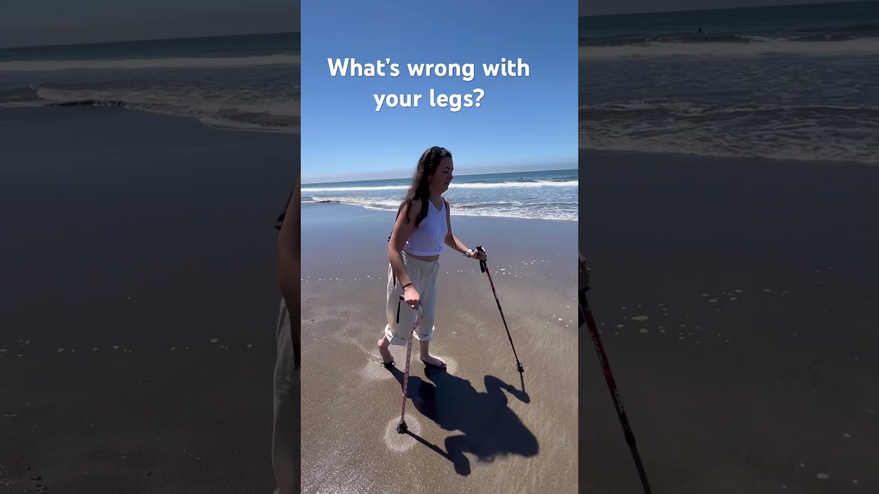 What&rsquo;s wrong with your legs? Hereditary spastic paraplegia