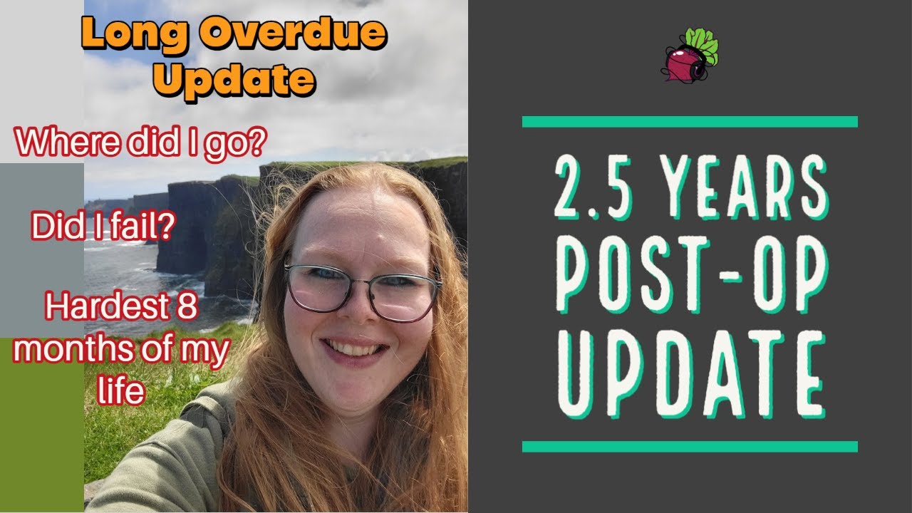 Where Have I Been? 2.5 Years Post-Op Update | My Gastric Bypass Journey