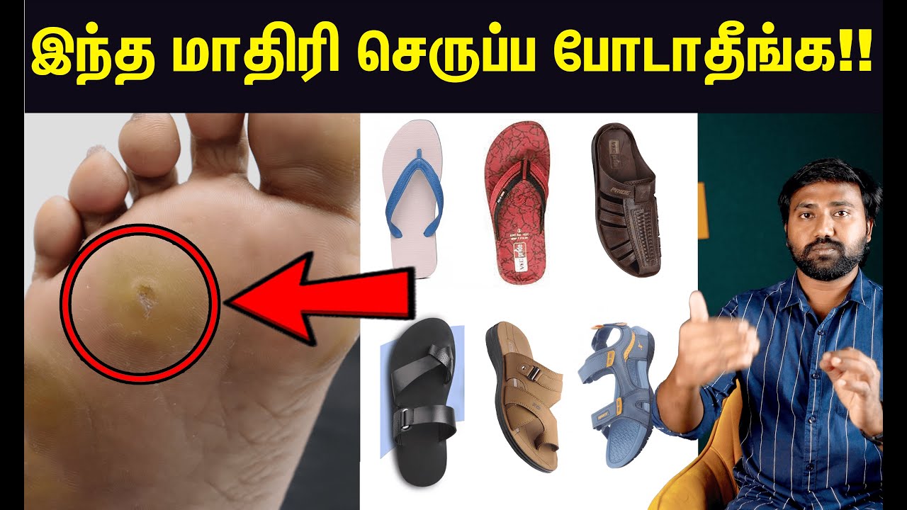 கால் ஆணி வராமல் இருக்க இத செய்யுங்க! | Foot Corn & Callus explained in Tamil | Uyirmei