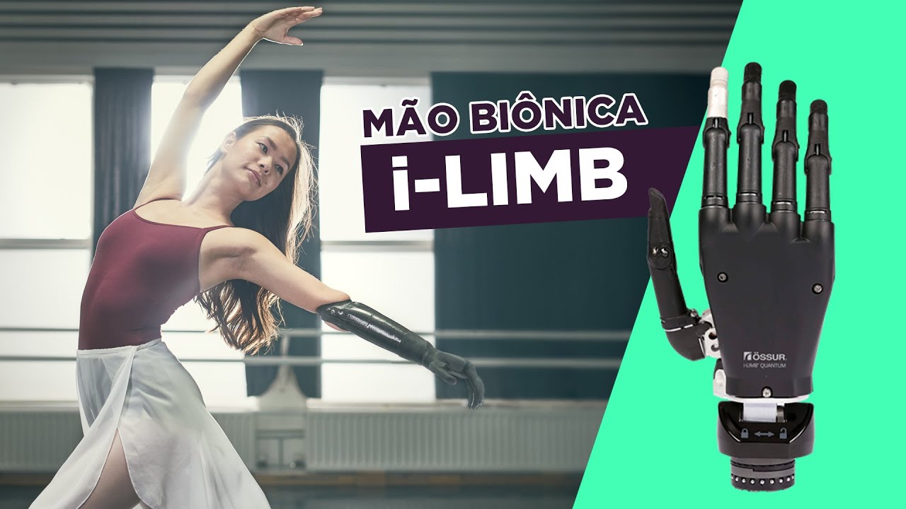 Próteses de Membro Superior: i-Limb da Össur