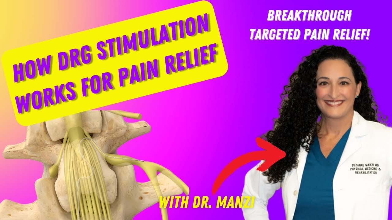 DRG Stimulation PPSM