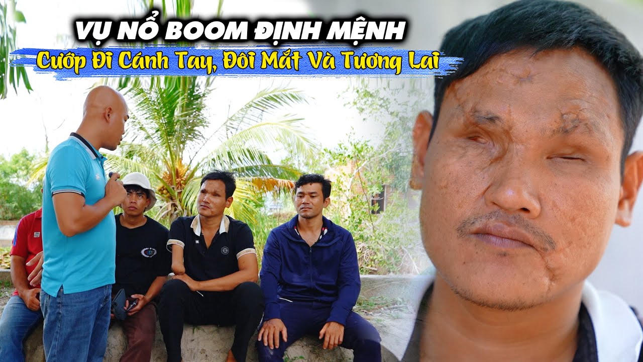 VỤ N.Ổ BO.OM ĐỊNH MỆNH CƯỚP ĐI CÁNH TAY ĐÔI MẮT VÀ TƯƠNG LAI CỦA MỘT HỌC SINH 8 TUỔI