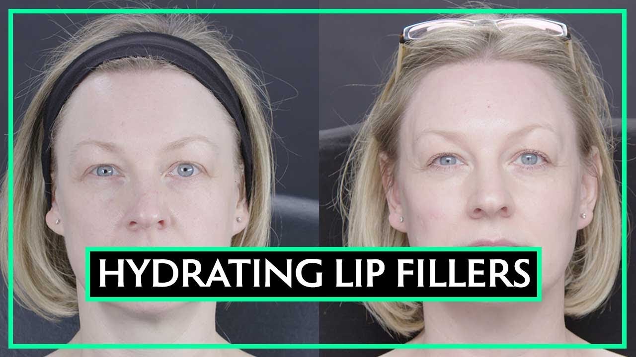 All About Hydrating Lip Fillers | Dr Sarah Tonks