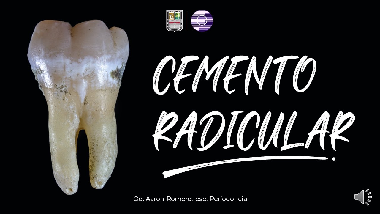 Clase de cemento radicular FOUC 2023