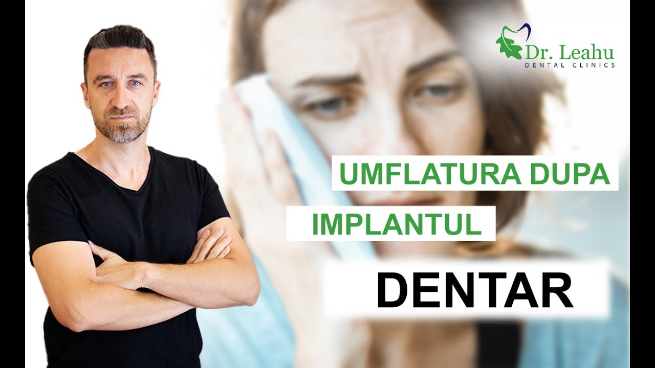 Cate implanturi se pot pune intr-o sedinta si ce trebuie sa stii despre umflarea fetei dupa implant