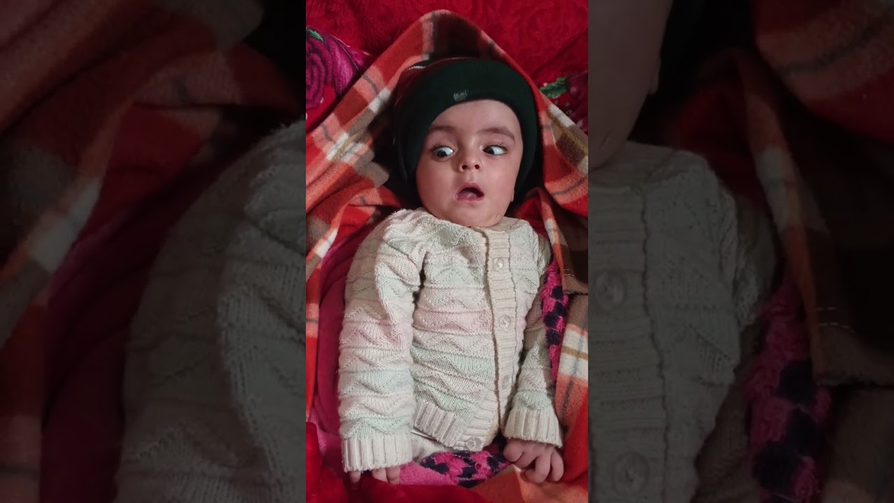 Abu BakarBaby Abu BakarAbu Bakar surgeryBaby surgery day Pray for Abu Bakar 