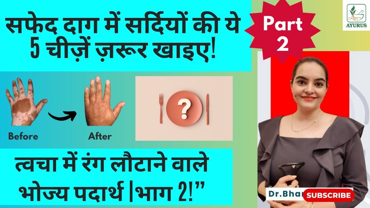 5 Winter Foods for Leucoderma – Part 2 | Benefits of Methi & Carrot | Dr. Bharti Makkar – Ayurus