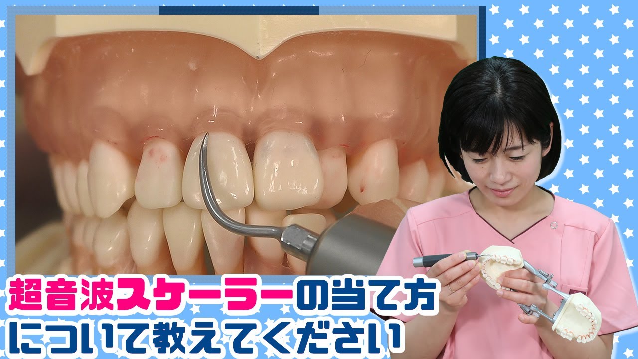 【超音波スケーラーの当て方について教えてください。】今更聞けない歯科知識 新人歯科衛生士さんのためのお悩み相談室/萬田久美子先生