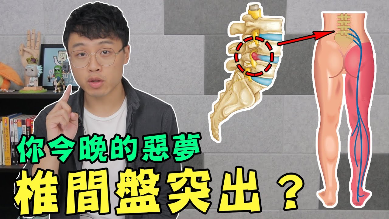椎間盤為什麼會突出？一定要開刀才能解決嗎？