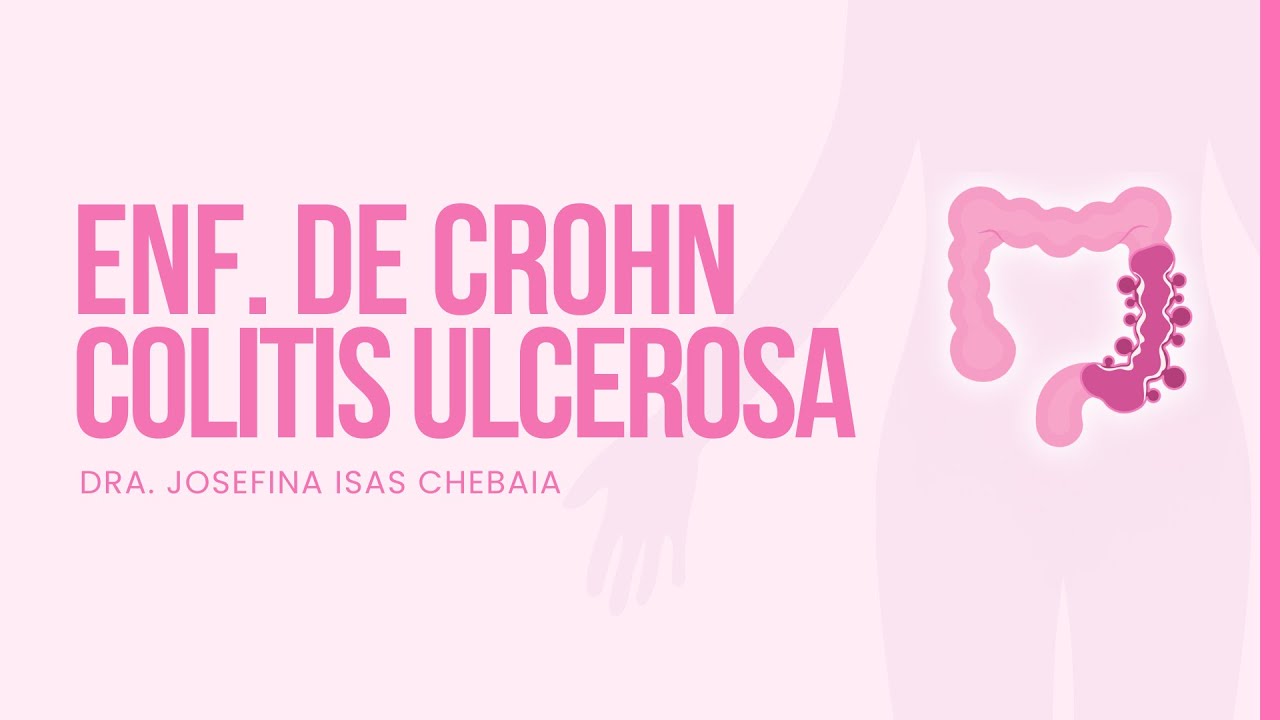 Colitis Ulcerosa vs Enfermedad de Crohn | Enfermedad Inflamatoria Intestinal (EII)