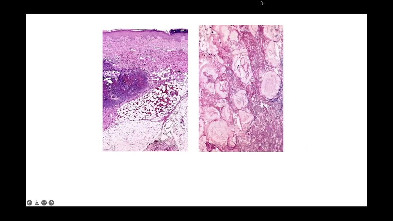 Essential dermatopathology part 2