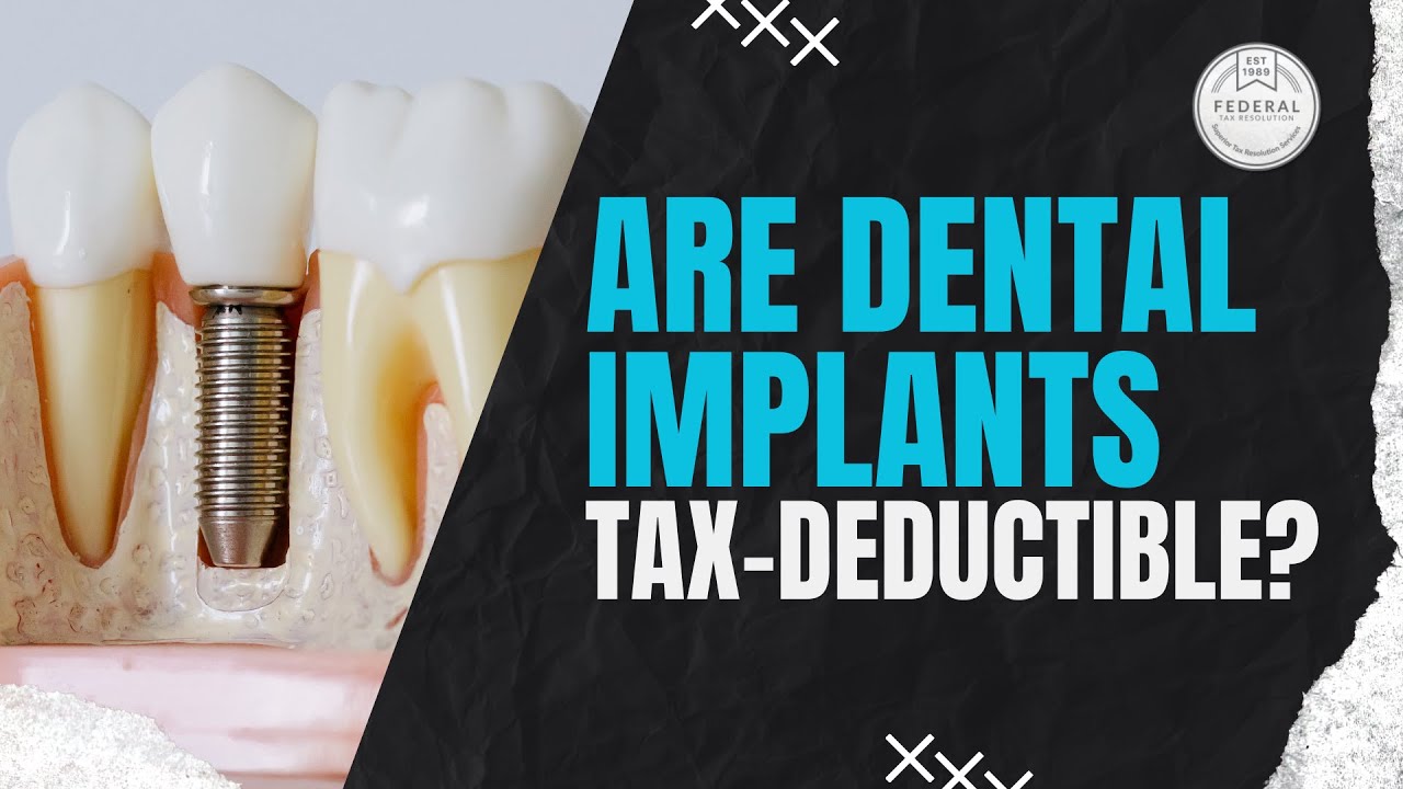Are Dental Implants Tax Deductible? | Federal Tax Resolution