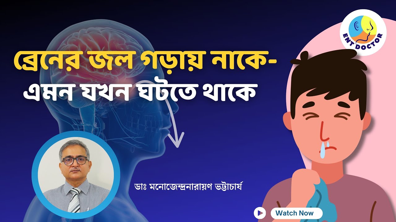 CSF rhinorrhea: ব্রেন লিক করে জল যখন নাক দিয়ে বেরয়