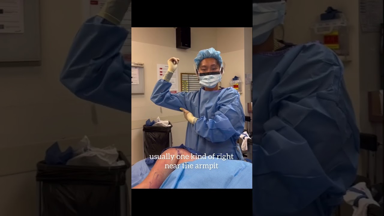 Arm Liposuction Procedure with Dr. Ginger Xu