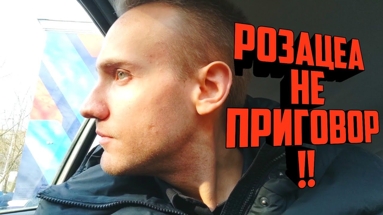 Как ВЫЛЕЧИТЬ РОЗАЦЕА? Как ИЗБАВИТЬСЯ от ПРЫЩЕЙ на лице? Розацеа на лице. Прыщи на лице. Розовые угри