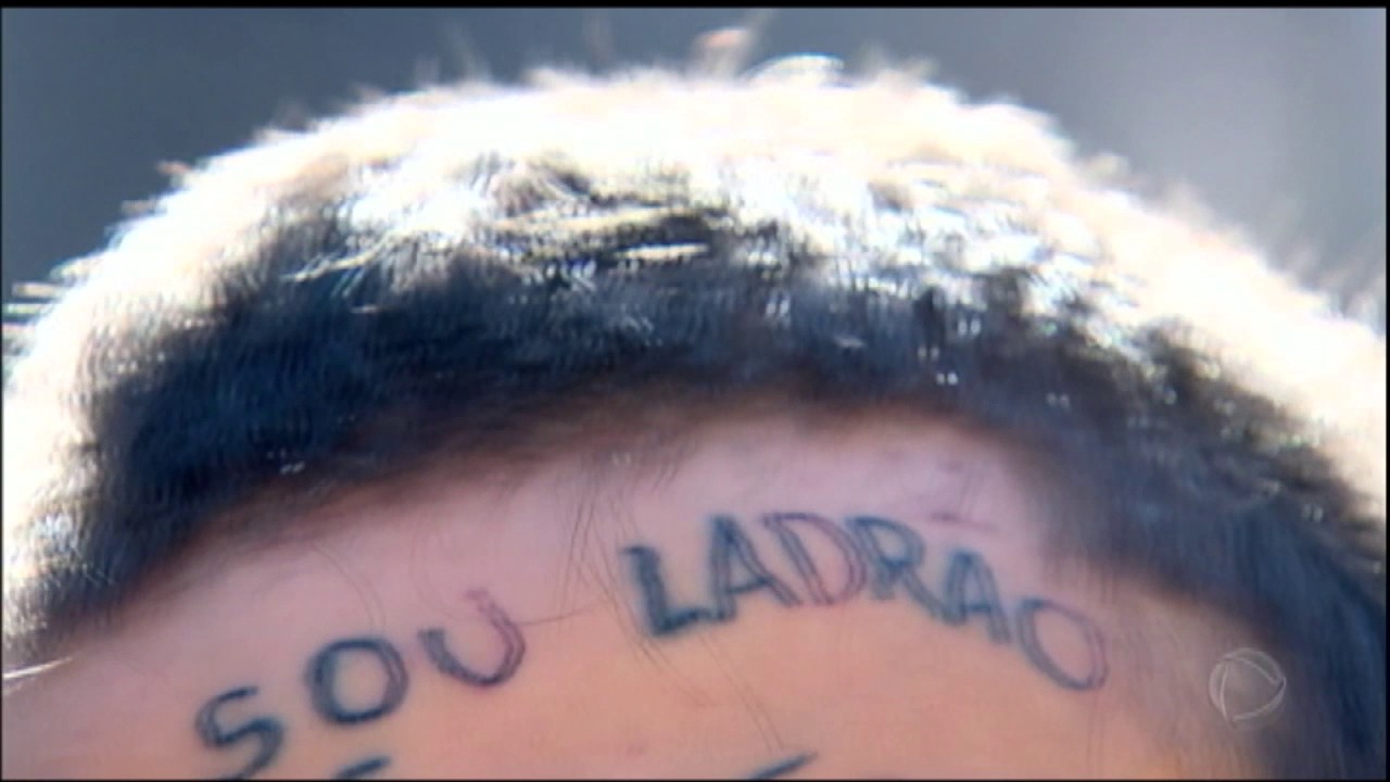 Conheça como funcionam técnicas de remoção de tatuagem