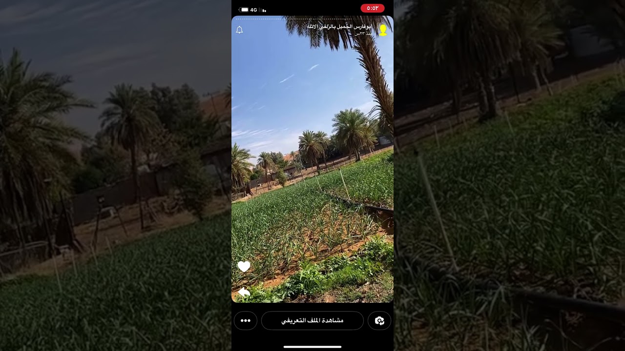 بعد زراعة الأسنان ماذا حدث