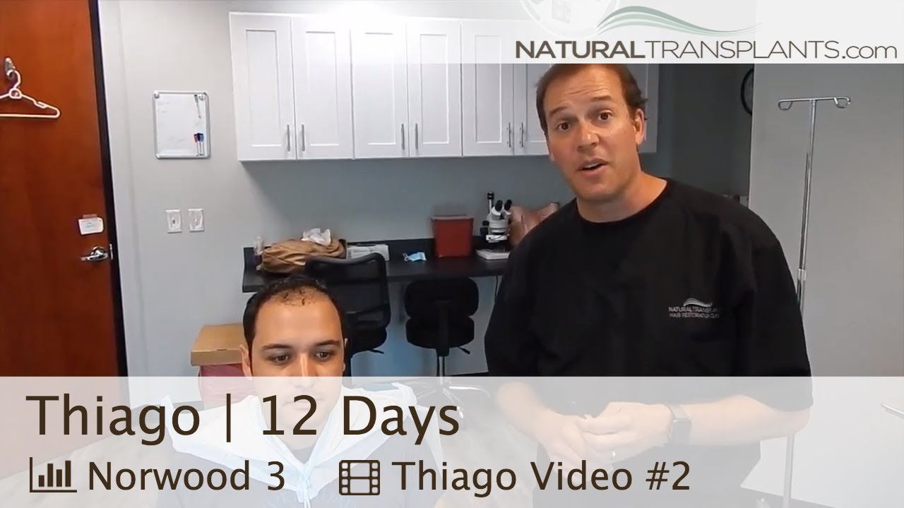 Hair Transplant FUT Suture Removal | Hair Transplant FUT Method (Thiago)