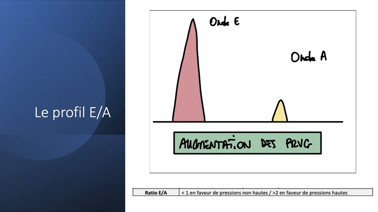 ECMU - Cardio :  Hémodynamique