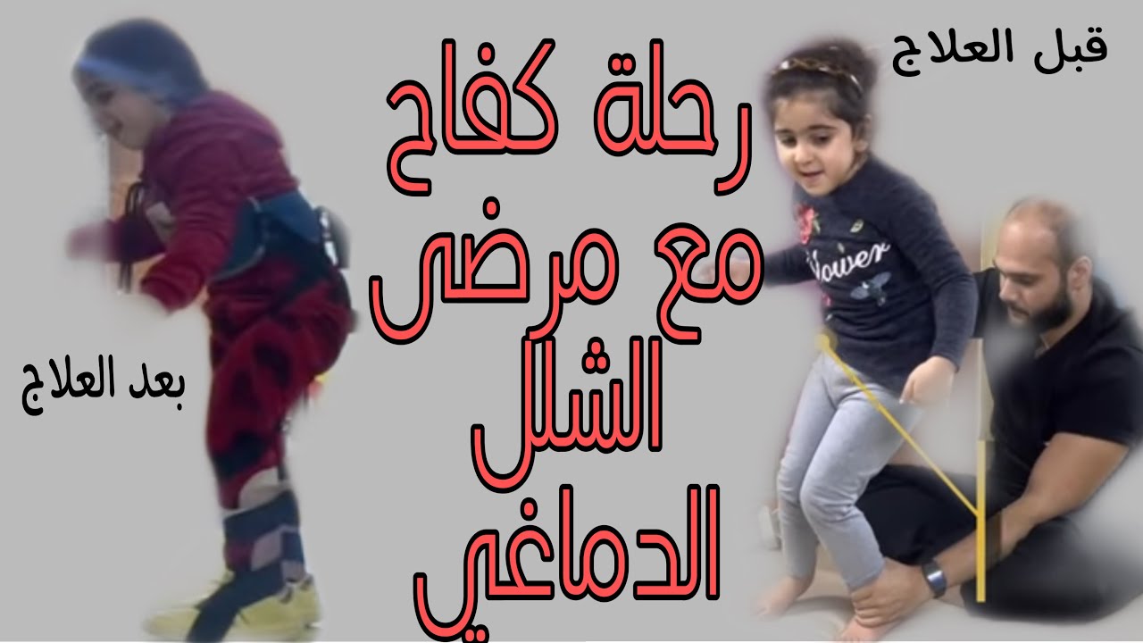 شفاء المريضة فاطمة بعد الدعاء والعلاج | رحلة كفاح مع مرض الشلل التشنجي