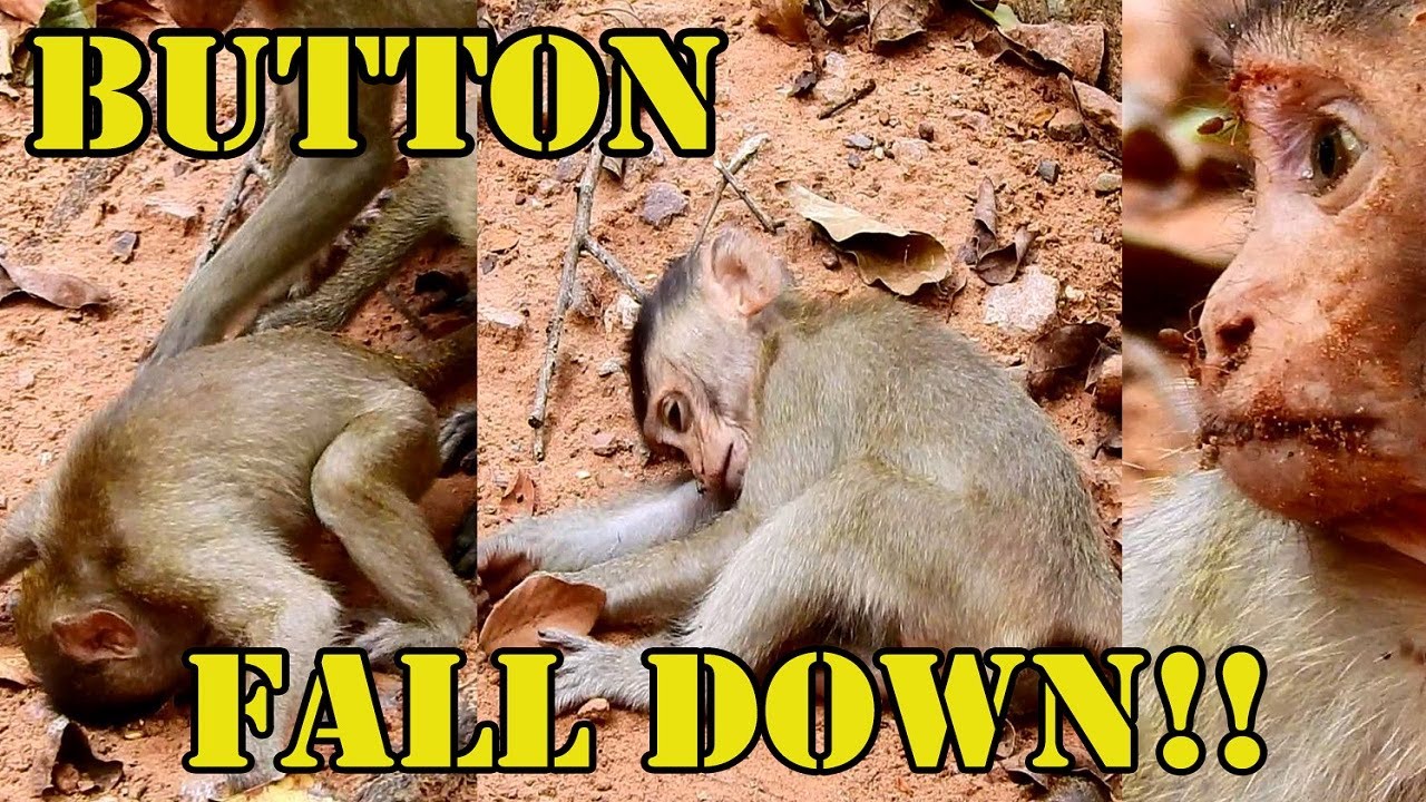 New Update! Million Sad Of Button Falls Down From The High Tree And Get Lost His Consciousness.