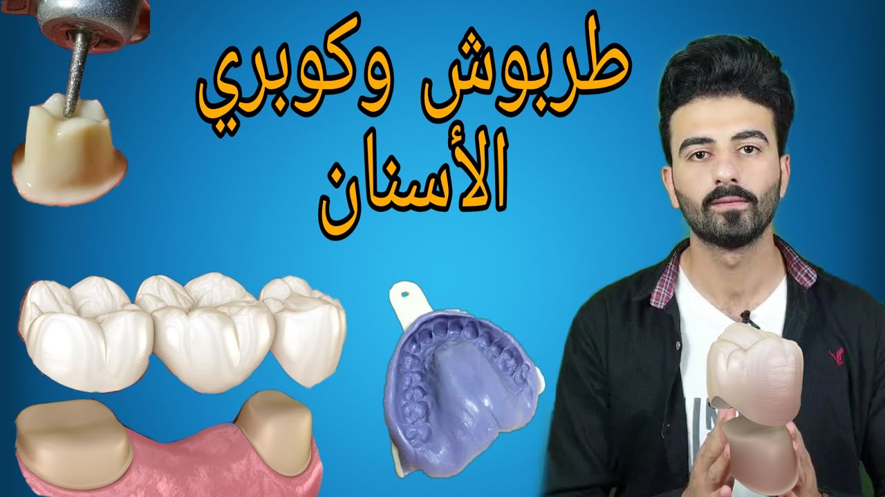 كل مايجب أن تعلمه عن الطربوش وكوبري الأسنان | Dental crown and bridge || preparation and impression