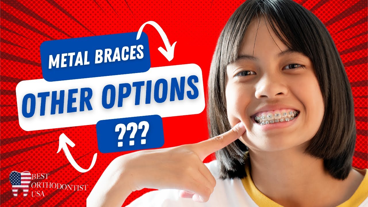 If You Don’t Want Traditional Metal Braces, What Are The Other Options?