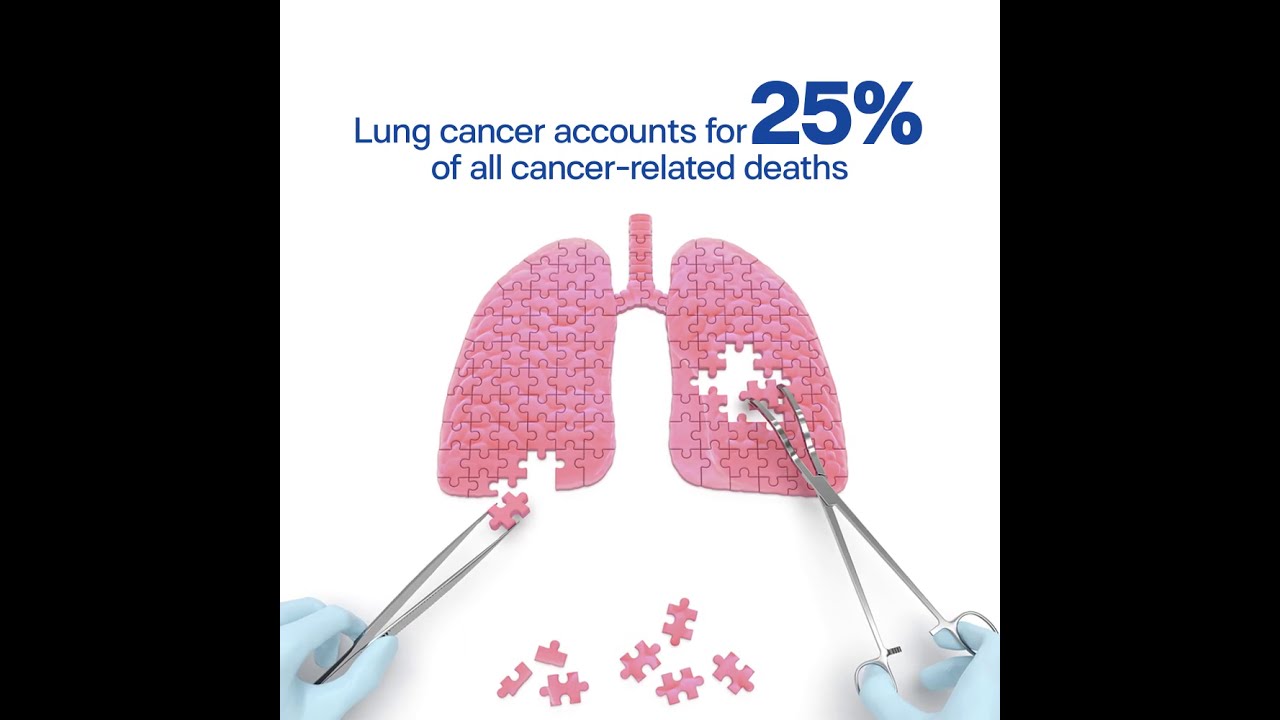 Lung Cancer Awareness Month