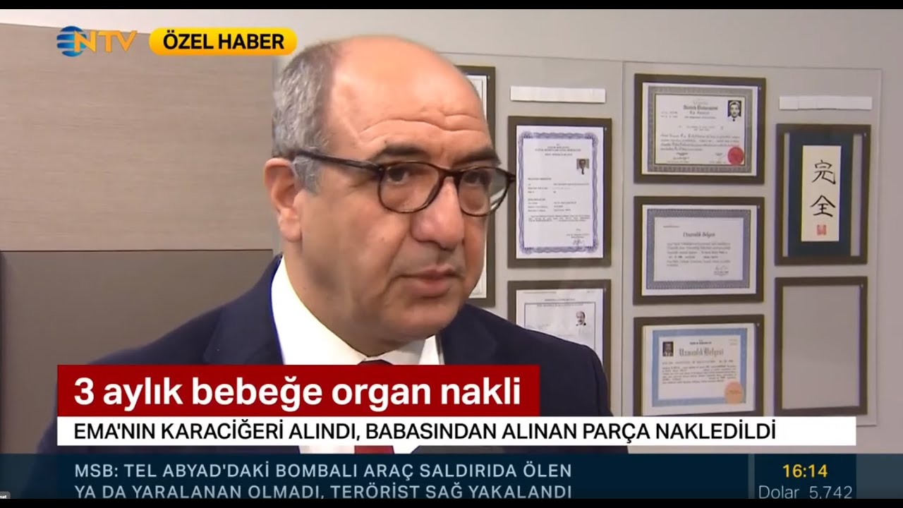3 aylık bebeğe organ nakli - Prof. Dr. Kamil Yalçın Polat