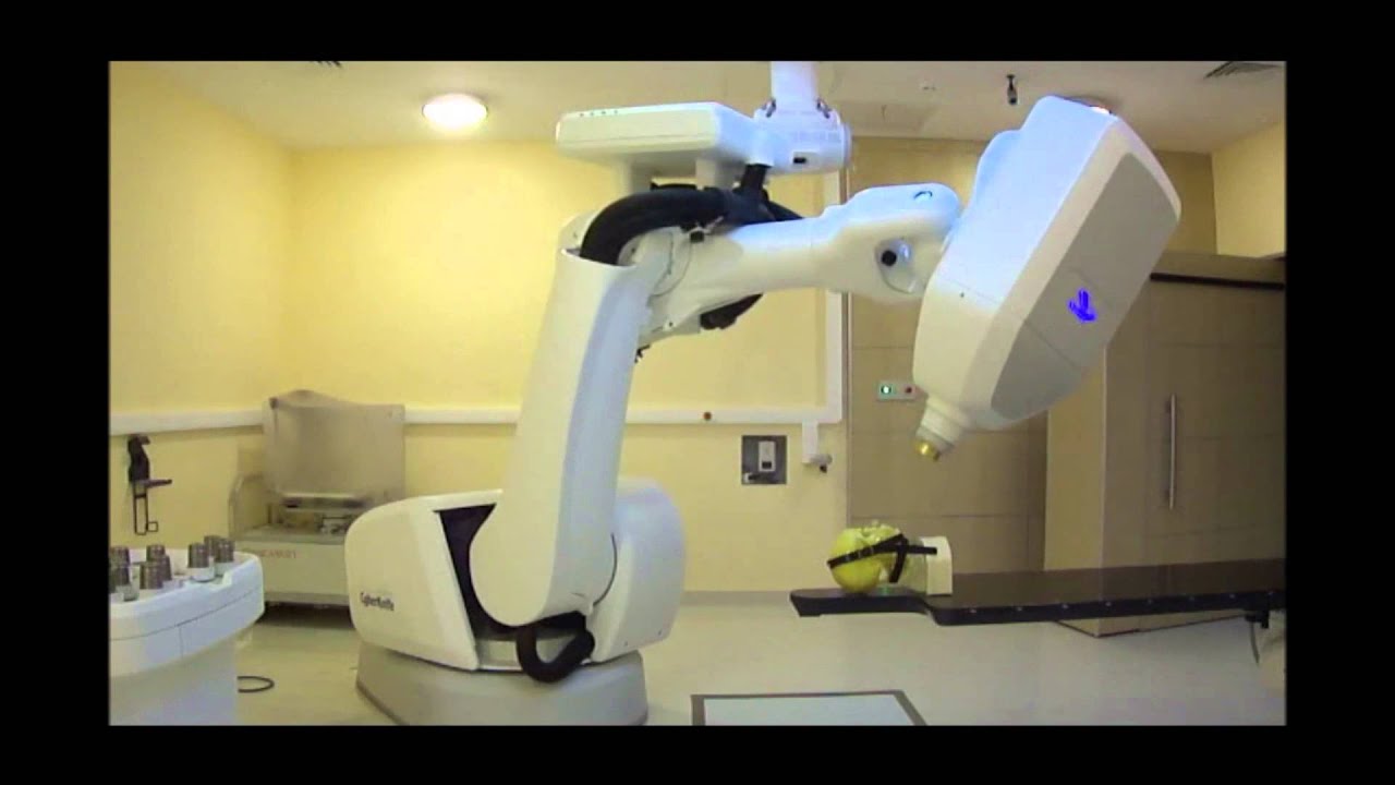 Radiosurgery at DTC IIBS