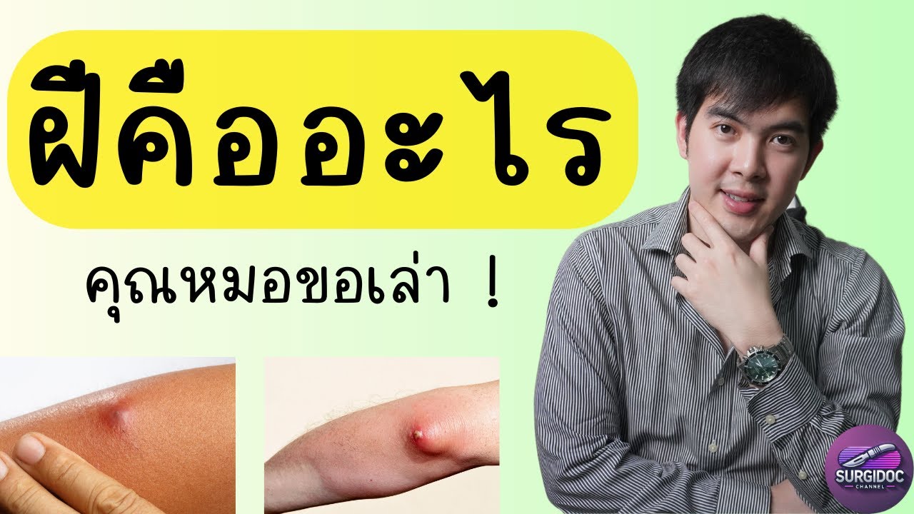 ฝีหรือหนอง คืออะไร ? สรุปสั้นเข้าใจง่ายจบใน 15 นาที l SURGIDOC EP.39