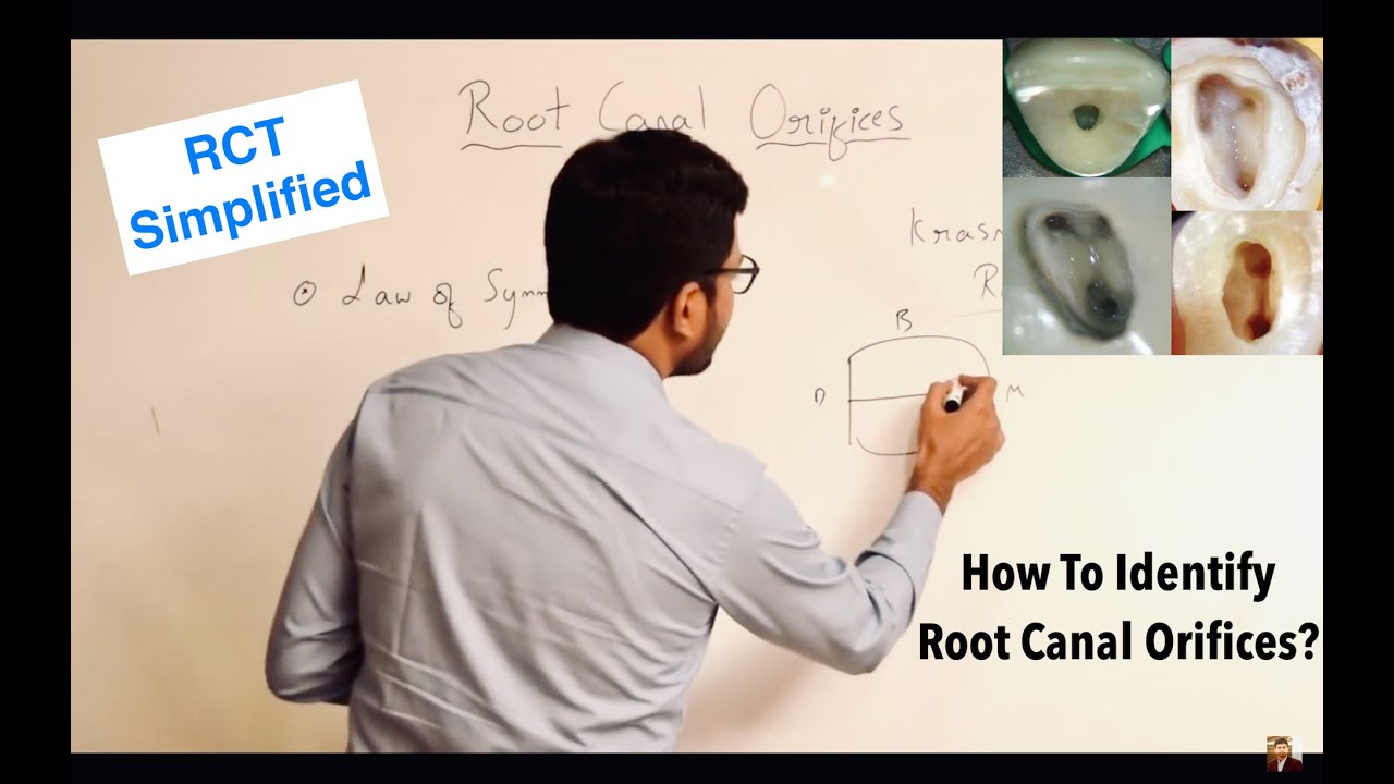 Root Canal Orifices Location - Laws | Topics In Description Below