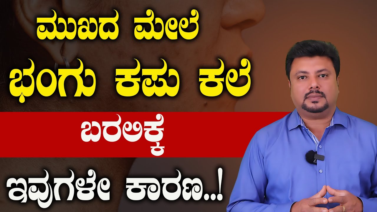ಮುಖದಲ್ಲಿ ಭಂಗು ಬರಲಿಕ್ಕೆ ಇವುಗಳೇ ಮುಖ್ಯ ಕಾರಣಗಳು | Bhangu Nivarane Mane Maddu | Pigmentation In Kannada