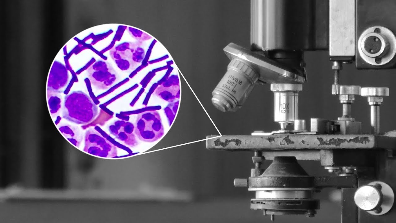 The Antibiotics Revolution Part 1: Sulfa Drugs