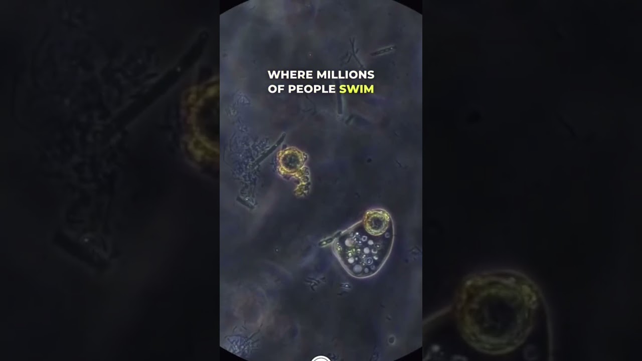 Brain Eating Amoeba Under Microscope #microscope #microscopy #science