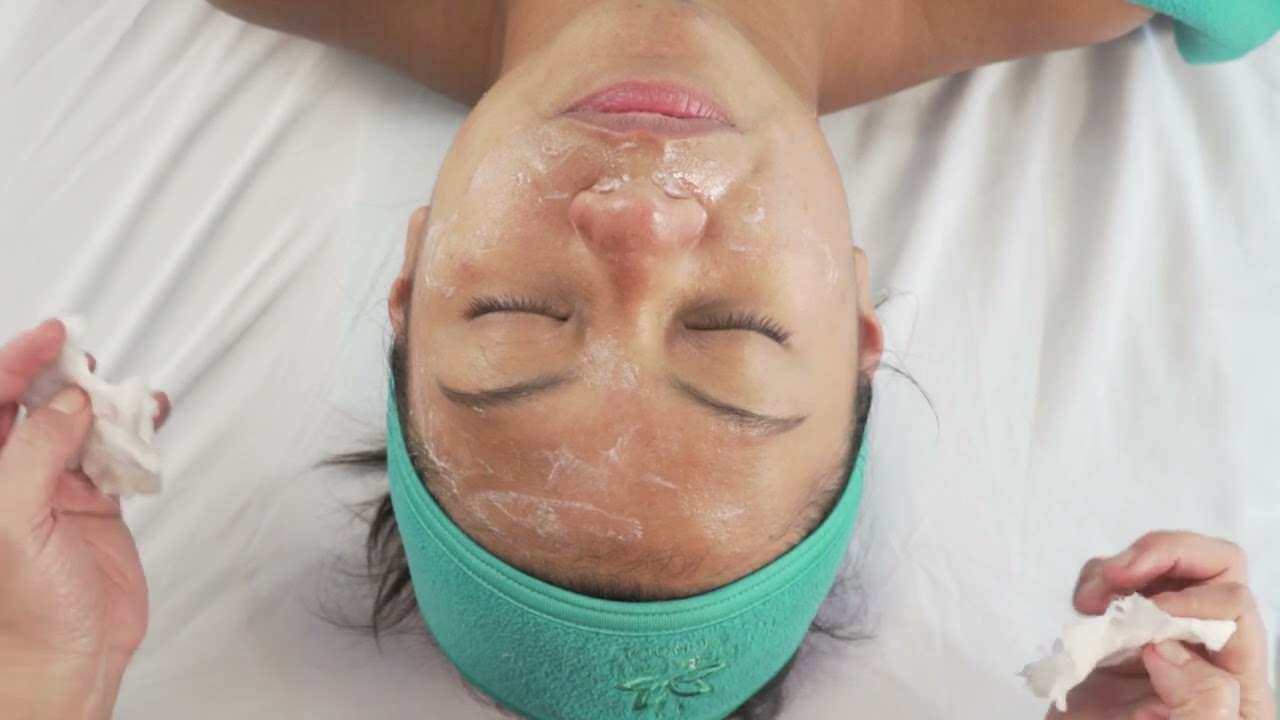 PEELING ULTRASONICO  tratamiento facial