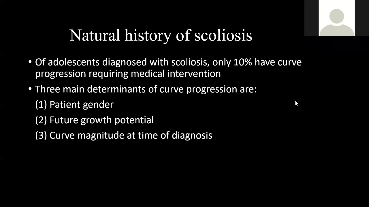 prof waleed hekal scoliosis from a to z part 3