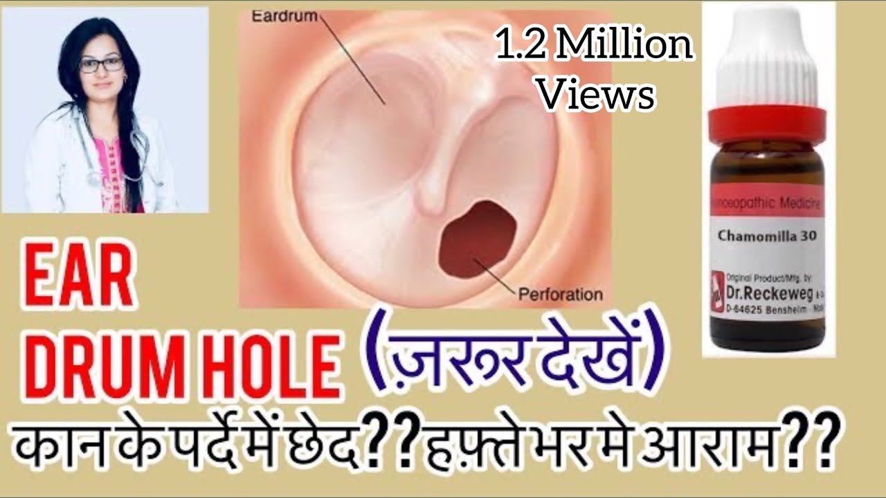 कान के पर्दे में छेद—Ear Drum Hole? Ruptured ?Best Homeopathic Medicine for Ear Drum Hole-Dr Rukmani