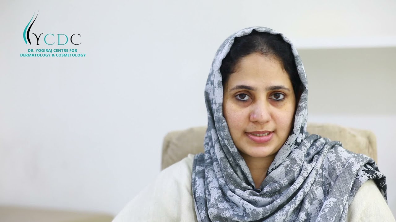 Hair loss Treatment for Females || YCDC – Yogiraj Centre for Dermatology & Cosmetology