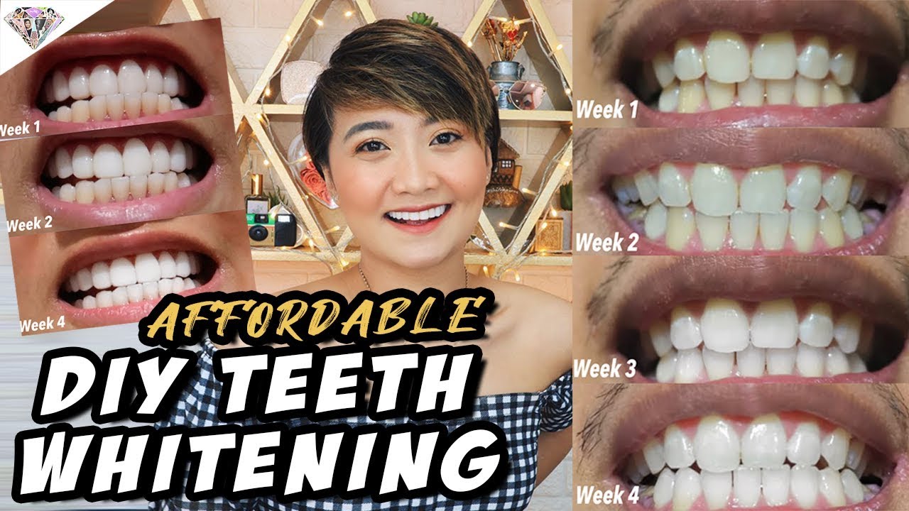 EFFECTIVE NA, AFFORDABLE PA NA DIY TEETH WHITENING | VLOGMAS DAY 12 | MAE LAYUG