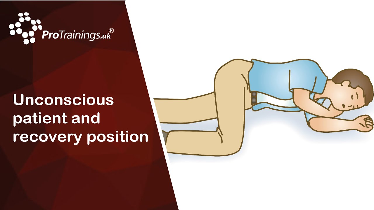 Unconscious patient and the recovery position