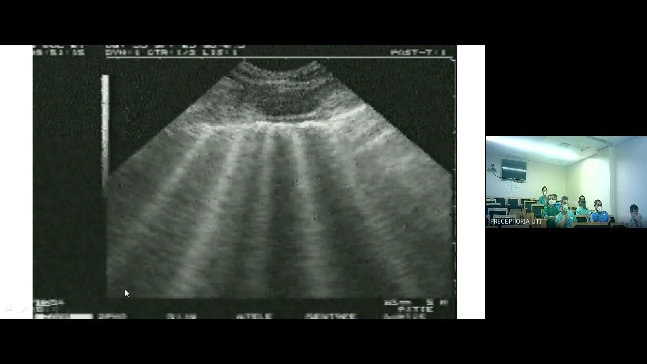 Ultrassom pulmonar
