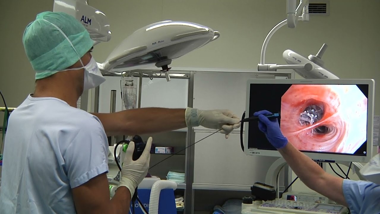 Emphysème pulmonaire : un traitement endobronchique innovant au CHU de Toulouse