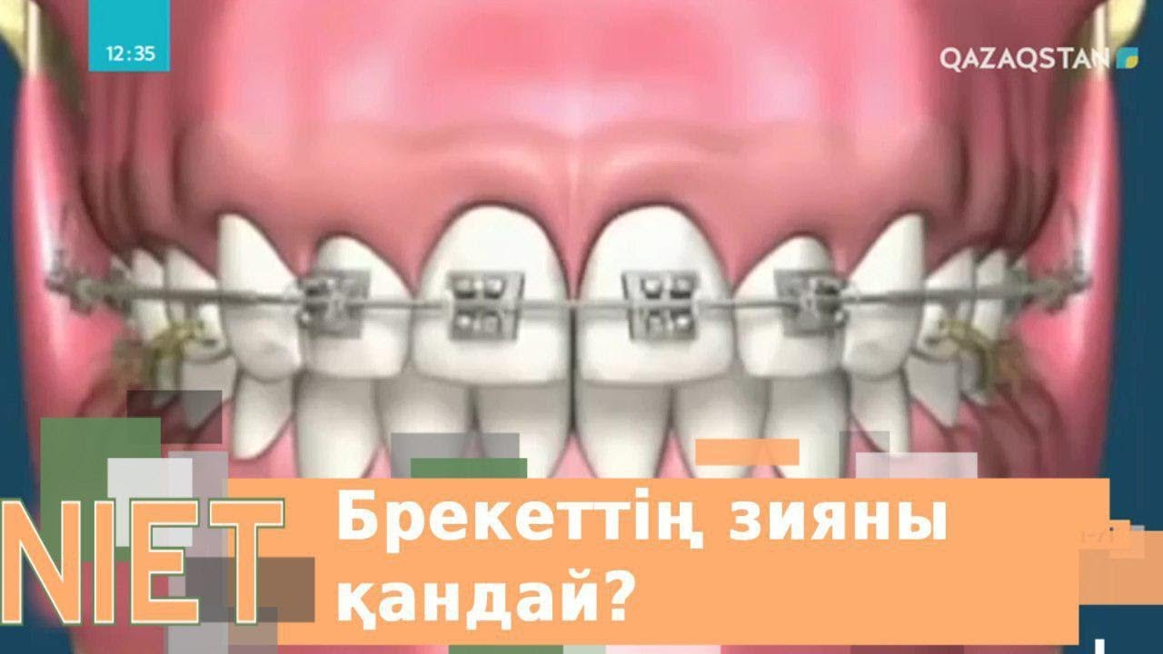 Брекет салудың зияны қандай?