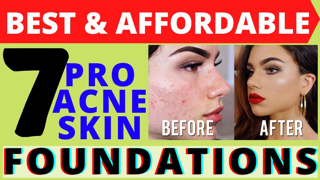 7 BEST & Affordable ACNE Skin FOUNDATIONS for PRO use, Ep-7